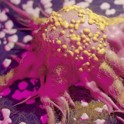 Image of a tumor cell