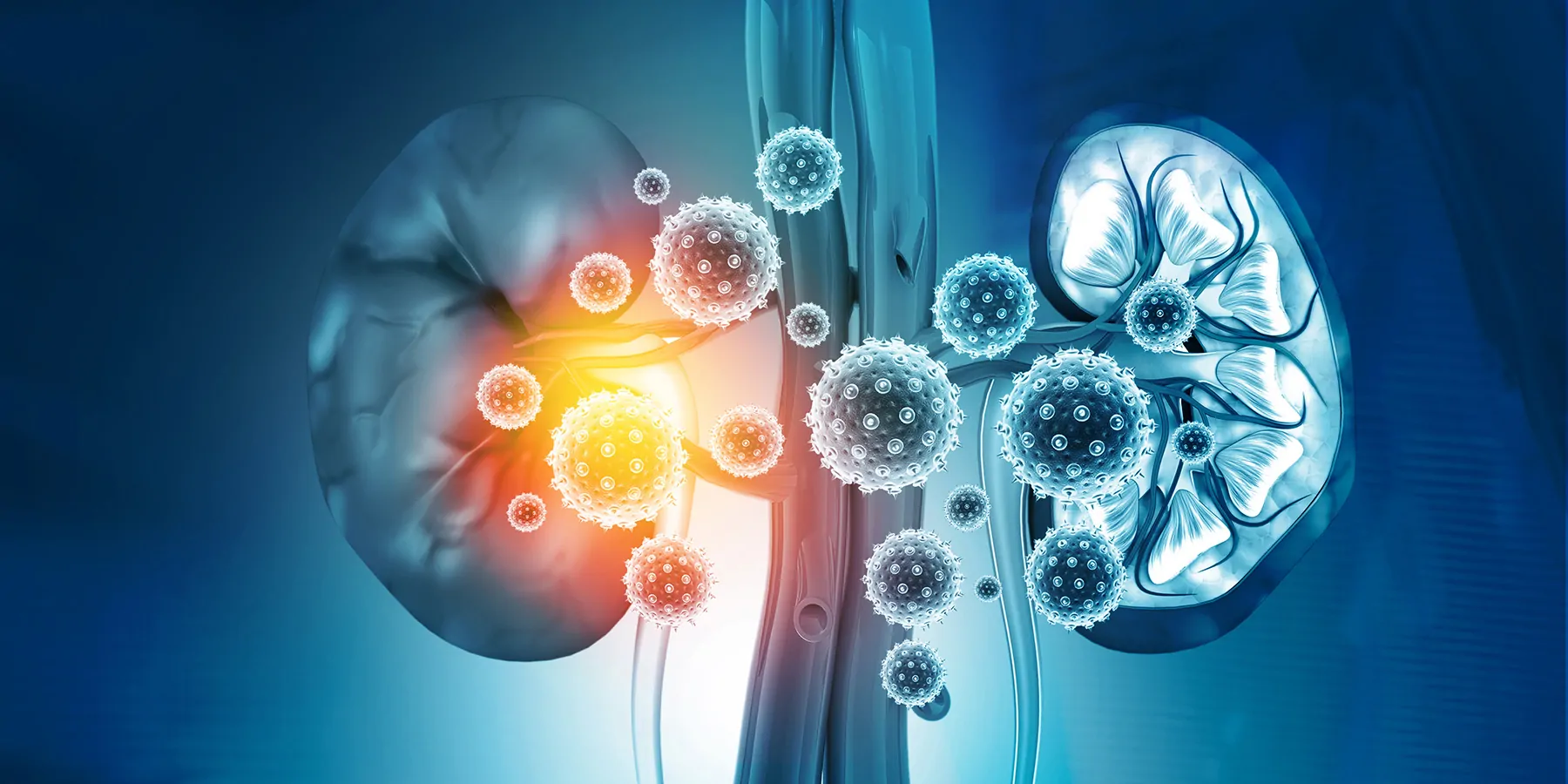 Computer image of human kidneys being damaged by infection