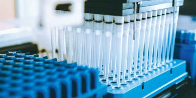 Photo of an automated next-generation sequencing sample library prep platform