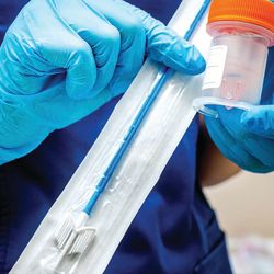 Advances in Cervical Cancer Screening: What Lies Beyond the Pap Smear?