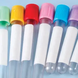 Photo of test tubes lined up against a blue background with rainbow colored caps