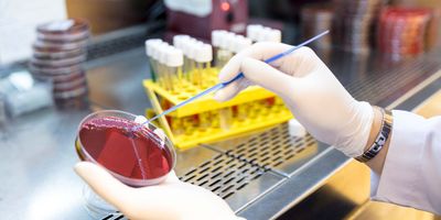 Researcher applying a smear to an agar plate