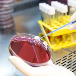 Researcher applying a smear to an agar plate