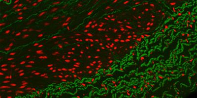 Photo of fluorescence in situ hybridization with red dots and green dots on a black background 
