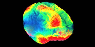 a 3D image of a human brain color coded on a black background