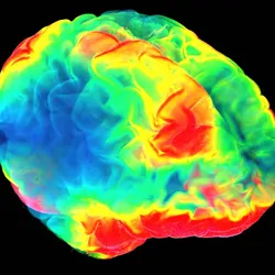 a 3D image of a human brain color coded on a black background