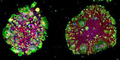 Staining image of ACE2-expressing iPS cells (after cryopreservation with STEMCELLBANKER-EX) infected with SARS-CoV-2. 