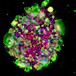 Staining image of ACE2-expressing iPS cells (after cryopreservation with STEMCELLBANKER-EX) infected with SARS-CoV-2. 