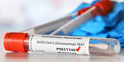 Covid test vial with a check beside the word positive on the label