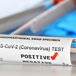Covid test vial with a check beside the word positive on the label