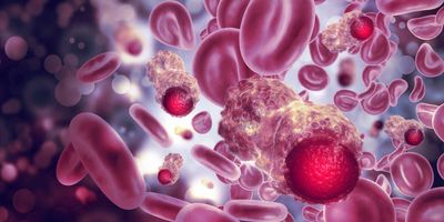 Computer image of cancer and blood cells in the body
