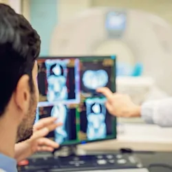 Researchers looking at a computer with MRI images on it
