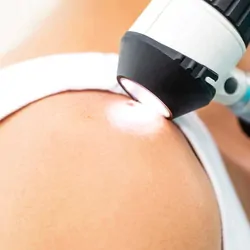 A patient having their skin examined for moles