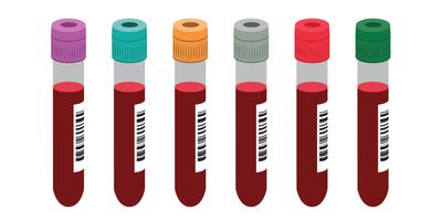 Even standard components can affect assay results
