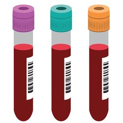 Even standard components can affect assay results