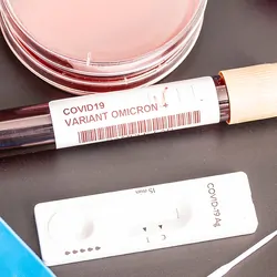 COVID-19 sampling and testing swabs and vials resting on a table