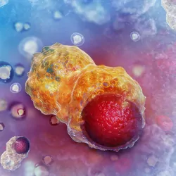 Computer image of cancer cells growing on tissue