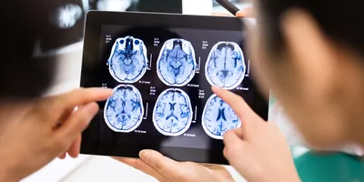 Health care providers looking at an MRI image on a tablet