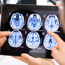 Health care providers looking at an MRI image on a tablet