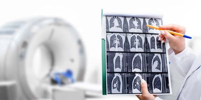 Health care rpovider looking at MRI images with MRI machine in background