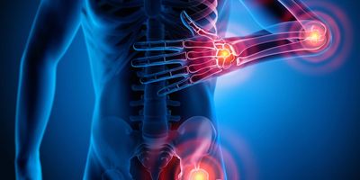 A computer image of a human body with red points indicating pain at the joints