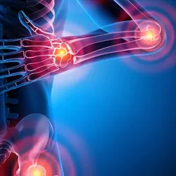 A computer image of a human body with red points indicating pain at the joints