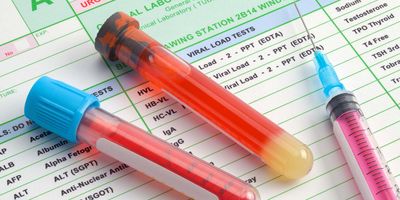 Blood test vials laying on a test sheet next to a needle