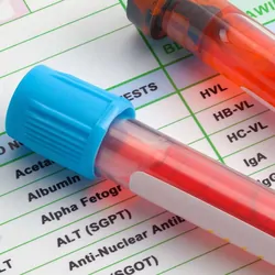 Blood test vials laying on a test sheet next to a needle