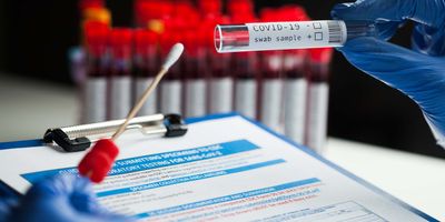 Health care provider with a COVID-19 test swab and clipboard