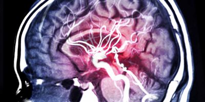 MRI image slice of a human brain 