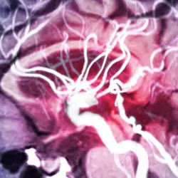MRI image slice of a human brain 