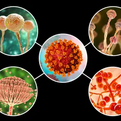 Opportunistic fungal infections present new challenges to health care providers on the front line of the COVID-19 pandemic