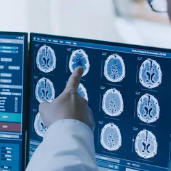 Researchers looking at an MRI image on a screen