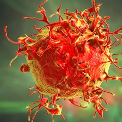 Computer image of red skin cancer cells on green backdrop