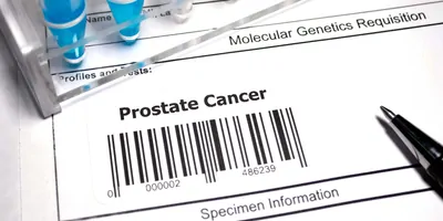 A form for a test with a barcode and the words prostate cancer on it next to liquid samples in tubes