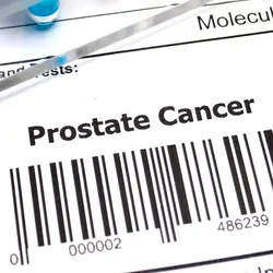 A form for a test with a barcode and the words prostate cancer on it next to liquid samples in tubes