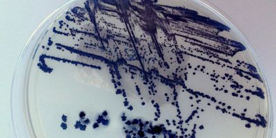 Agar plate with bacterial growth smear in purple