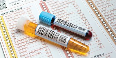 Photo of a patient's urine sample and blood sample on top of a flex panel test checklist