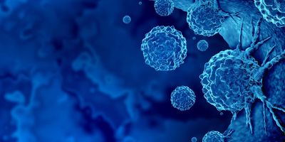 Computer image of cancer cells colored blue on a blue background