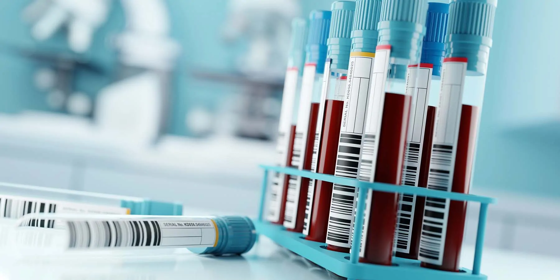 Blood Specimen Collection Tube Shortage A rack of full blood collection tubes with blue tops