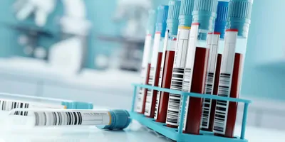 A rack of full blood collection tubes with blue tops