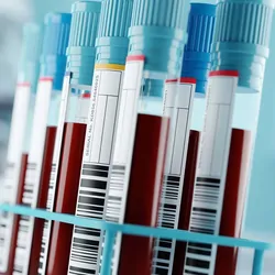 A rack of full blood collection tubes with blue tops