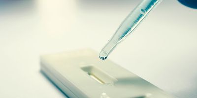 Photo of an over-the-counter rapid antigen COVID=19 test.