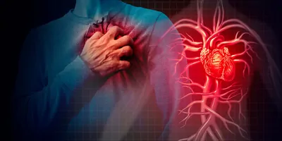 double exposure of a man clutching his chest over the heart, and an image of the cardio vascular system in red, on a black background