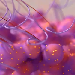 Cancer cell, cell grow out of control and become invasive