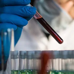 Researcher in PPE looking at a blood vial with blood