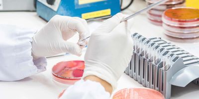 Photo of a clinical lab professional adding a patient sample to a culture plate.