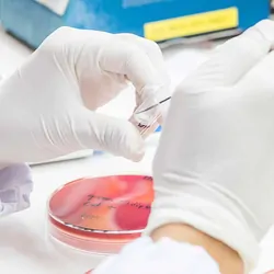 Photo of a clinical lab professional adding a patient sample to a culture plate.