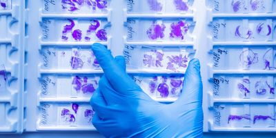 Photograph of fixed samples being prepared for analyte extraction.