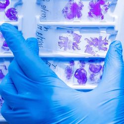 Photograph of fixed samples being prepared for analyte extraction.